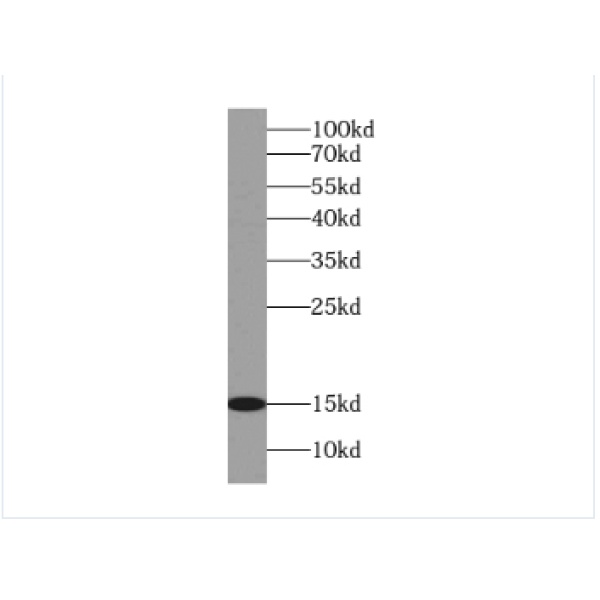 anti- CISD2-Specific antibody