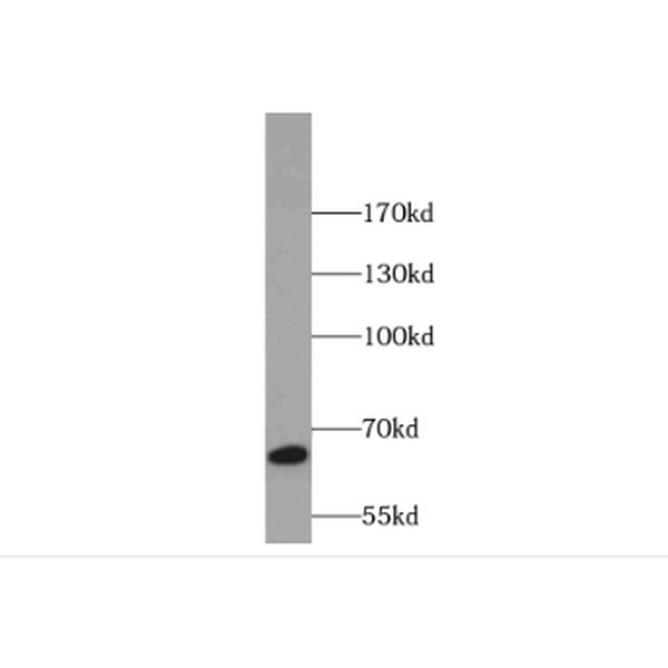 anti- Annexin VI antibody