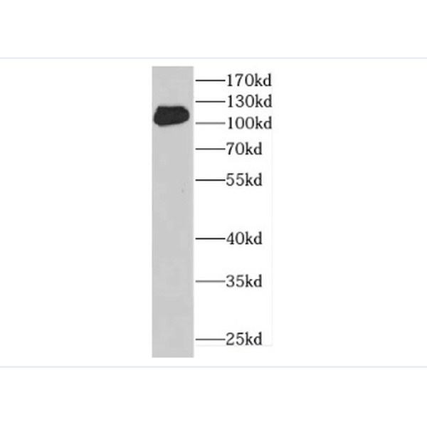 anti- Desmocollin 2 antibody