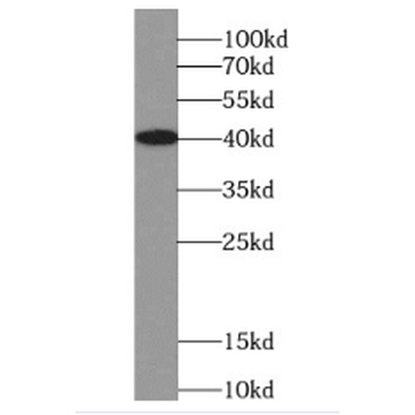 anti- Interferon gamma antibody