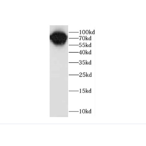 anti- Caldesmon antibody