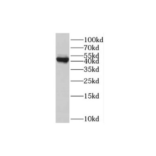 anti- Biglycan antibody