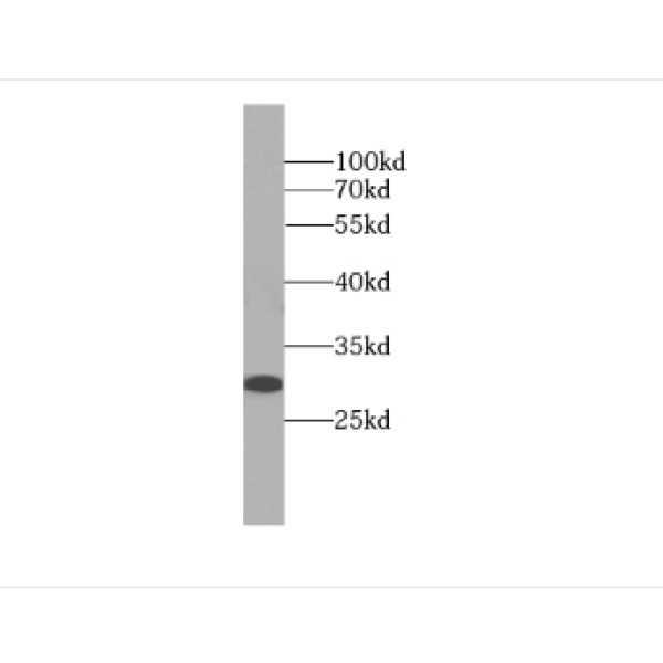 anti- DNAJB3 antibody