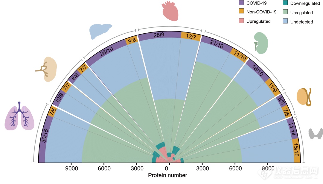 西湖大学郭天南等首次揭示新冠患者蛋白质分子病理全景图