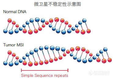 NMPA批准国内首个微卫星不稳定（MSI）检测试剂盒（多重荧光PCR-毛细管电泳法）