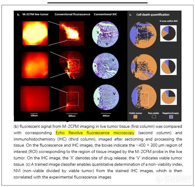 文献速递 | 肿瘤药物反应检测平台以ECHO荧光显微镜为成像辅助研究