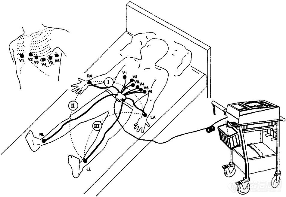 心电图机6.jpg