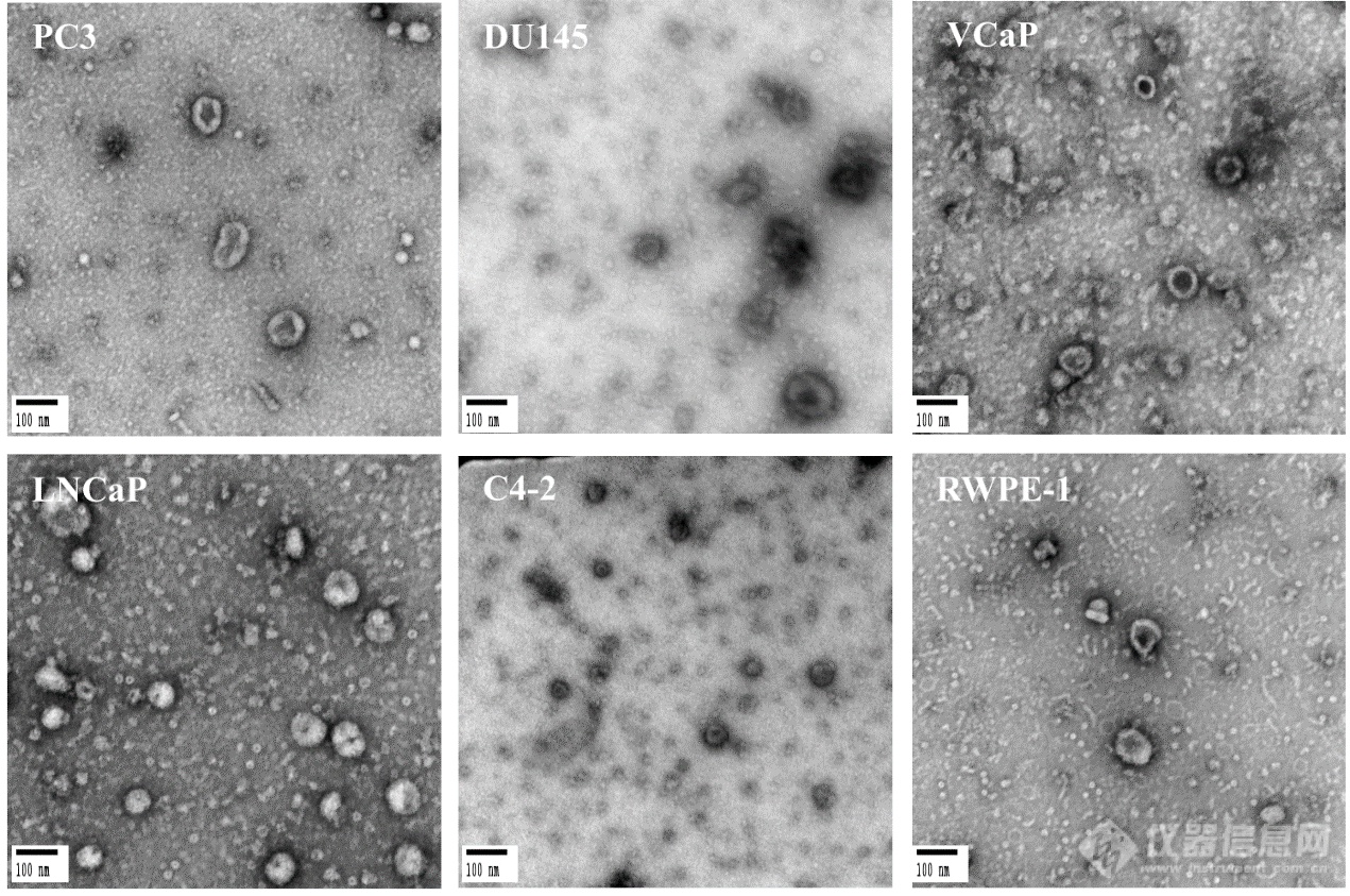 外泌体粒径分析该选谁？不同外泌体粒径分析技术间的比较