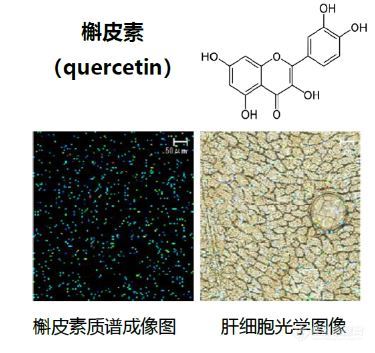 “慧眼”观微—成像质谱显微镜iMScope QT开箱测评