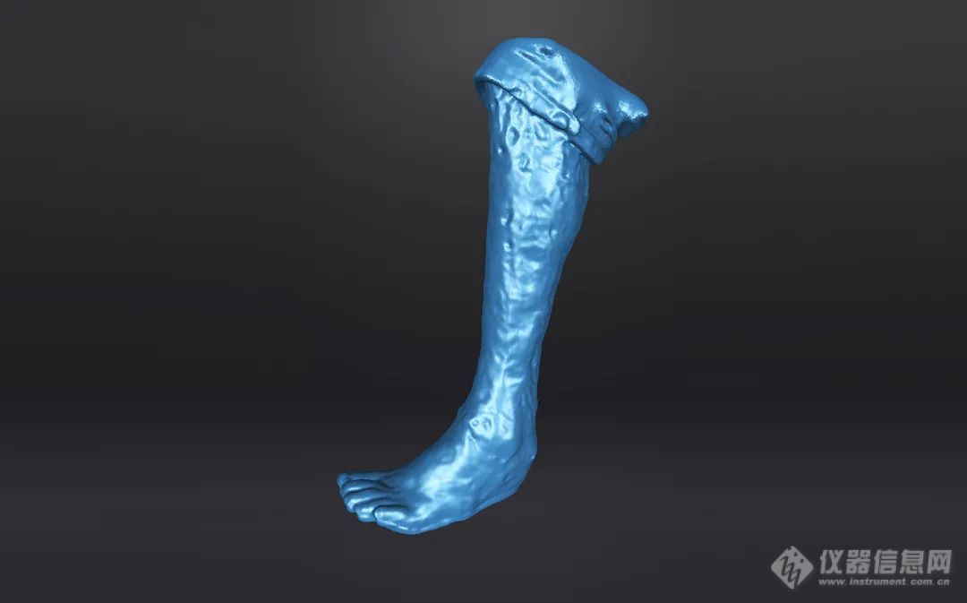 定制足托，先临三维3D数字化技术帮助烧伤患者正常行走