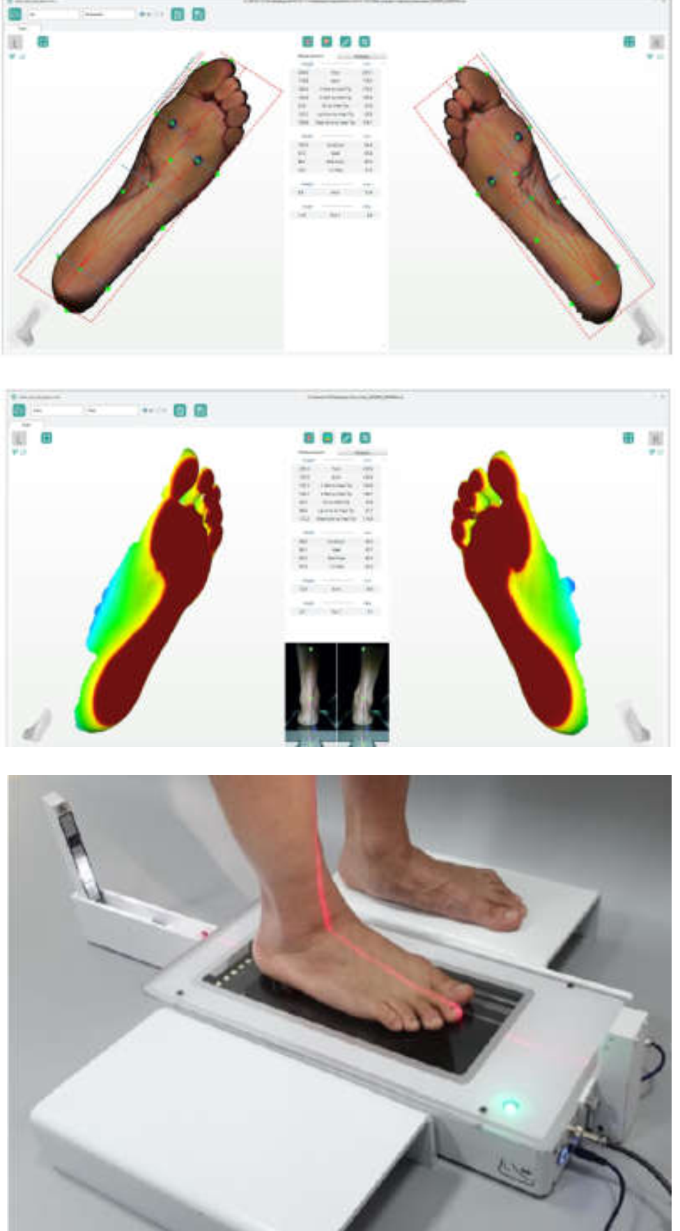 HF足底3D扫描仪