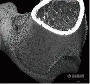 岛津微焦点X射线CT助力动物实验-小鼠股骨CT观察