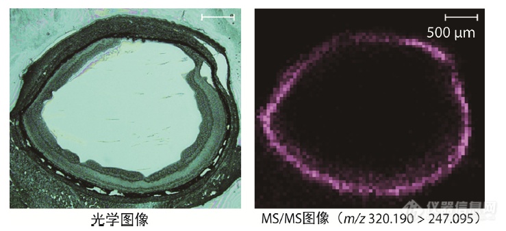 岛津成像质谱显微镜应用专题丨视网膜药物分析