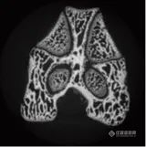 岛津微焦点X射线CT助力动物实验-小鼠股骨CT观察