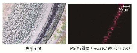 岛津成像质谱显微镜应用专题丨视网膜药物分析