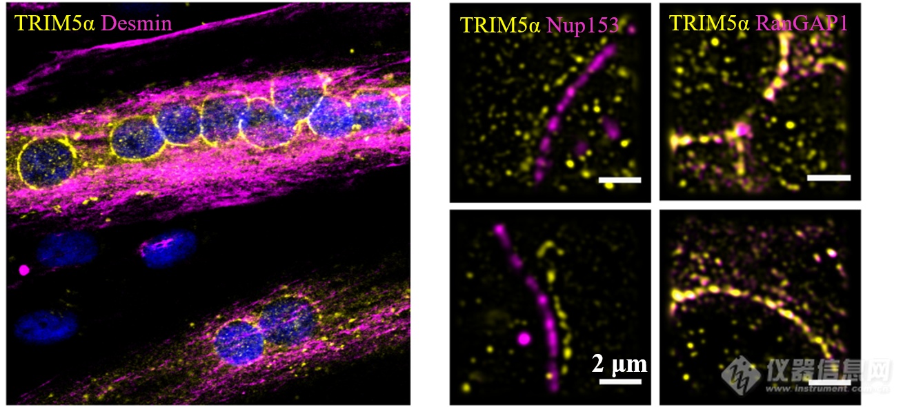 天然免疫分子TRIM5α作用机制研究.png