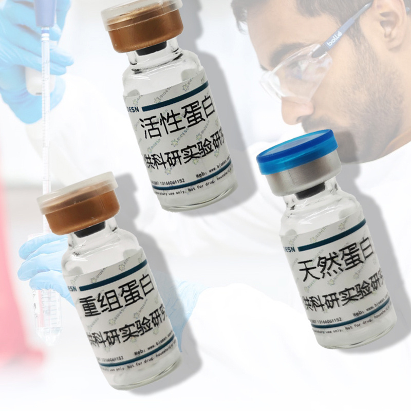 IL-18R&#945; Protein, Human, Recombinant (His & hFc Tag)