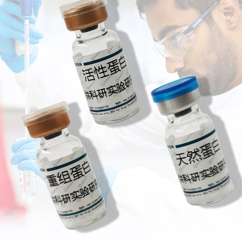 LAG3 Protein, Human, Recombinant, HPLC-verified