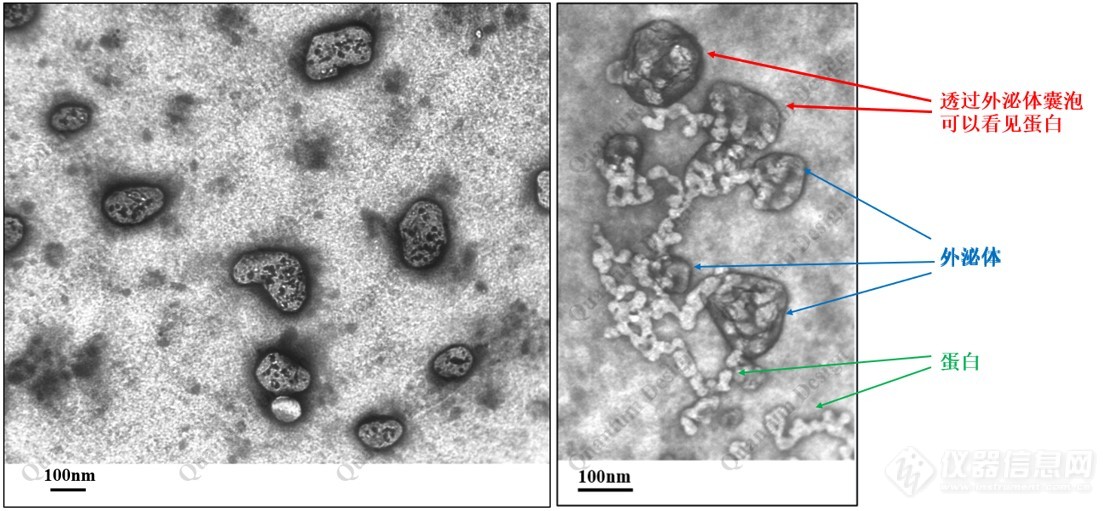 非负染外泌体成像.jpg