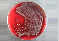 美国ATCC23355阴沟肠杆菌原装进口带证书