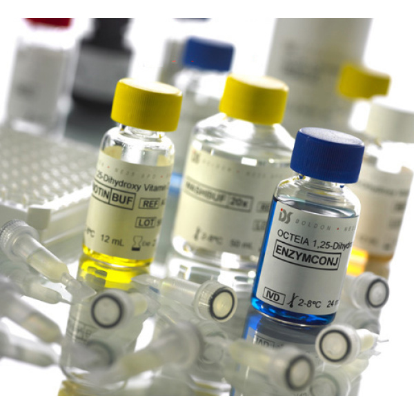 艾狄斯®1，25双羟基维他命D检测试剂盒（酶联免疫法）