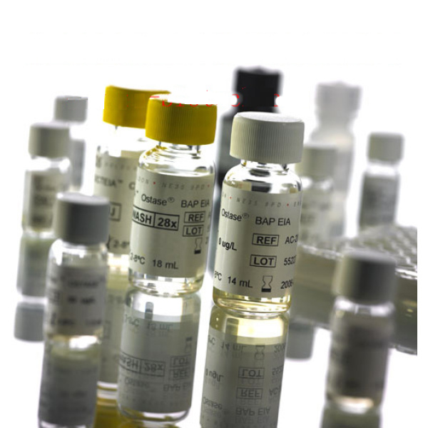 艾狄斯®骨碱性磷酸酶检测试剂盒（酶联免疫法）