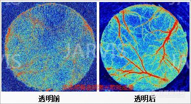 活体颅骨透明激光散斑成像P后.jpg