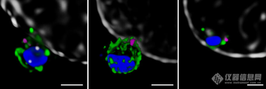 csm_Malaria-sted_14_2c09ed95f8.jpg