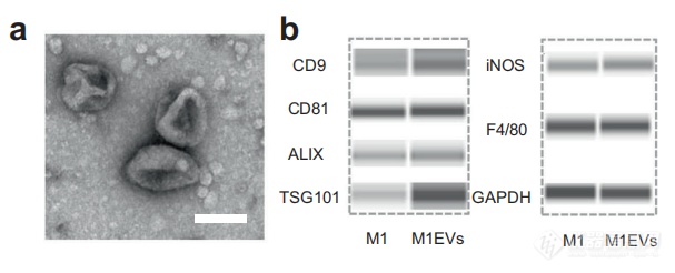 细胞外囊泡又双叒叕大显身手！