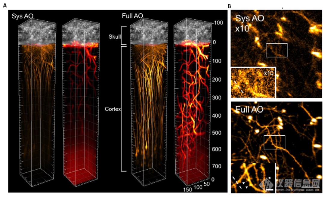 Nature子刊：香港科技大学瞿佳男团队开发活体高分辨大脑成像新技术