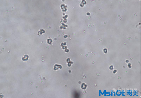 国产生物显微镜搭配显微镜相机观察到乳酸菌