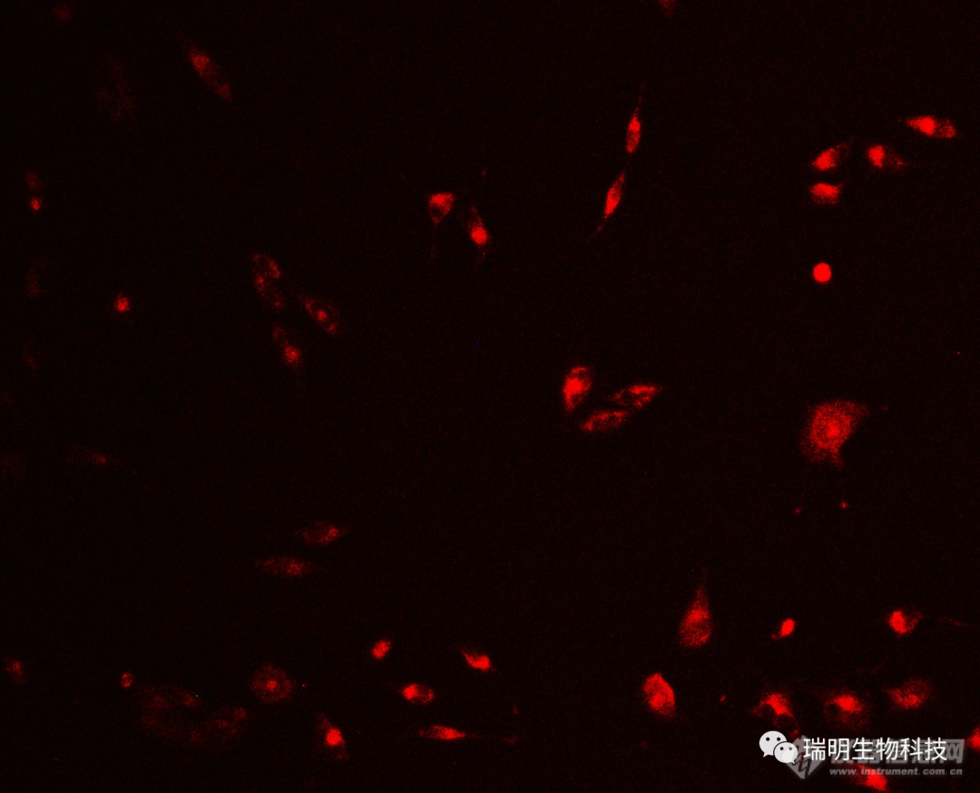 新品速递|瑞明生物发布微型活细胞监测系统,实现整机放入培养箱云端同步数据