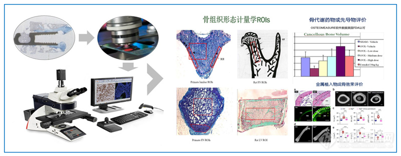 财政贴息贷款项目 | 从新鲜骨组织到骨形态计量分析的整体解决方案