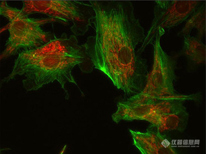 使用明慧显微镜荧光led光源实拍效果图