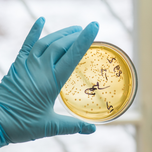 微生物检测用玻璃器皿的清洗攻略