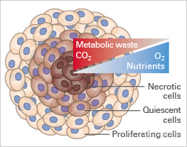 fig_1b_tumor_spheroid.jpg