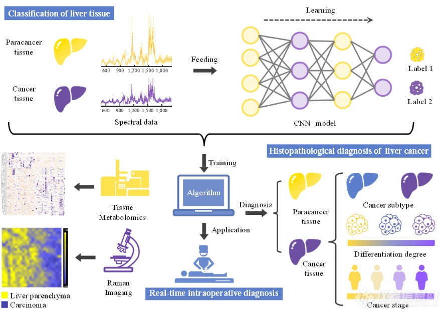 拉曼光谱组织病理学诊断和术中检测取得进展