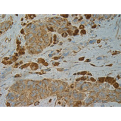 点突变抗体 BRAF (V600E) 小鼠单抗/BRaf(V600E)  Antibody