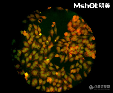 荧光生物显微镜应用于ANA-HEp2免疫荧光诊断