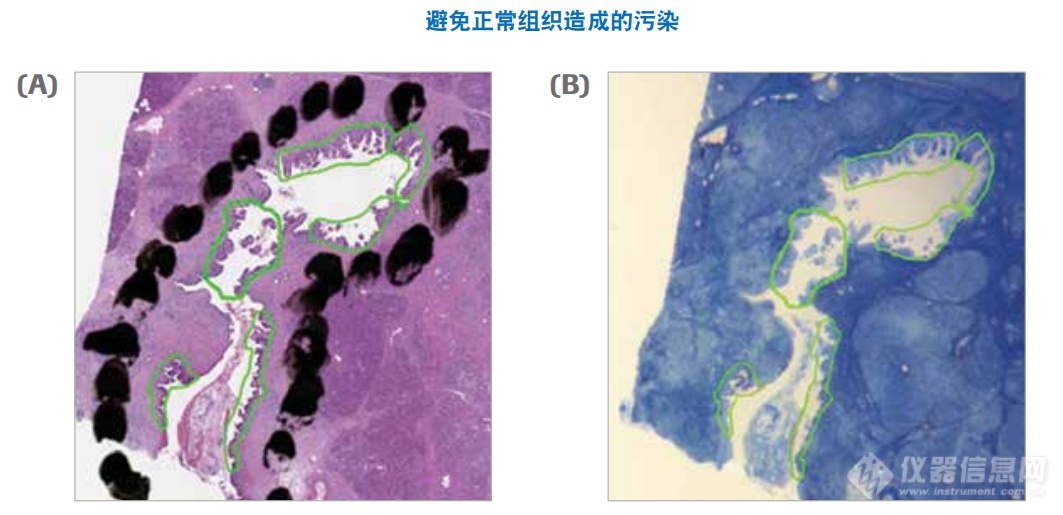 避免正常组织造成的污染.png