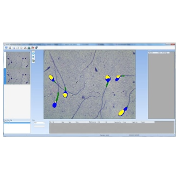 精子质量分析仪，全自动精子分析仪