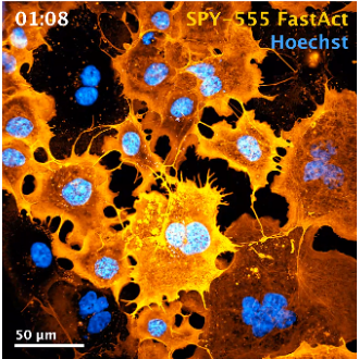 SPY555-FastAct&trade;新型荧光活细胞肌动蛋白探针
