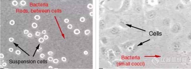 细菌污染的细胞图片