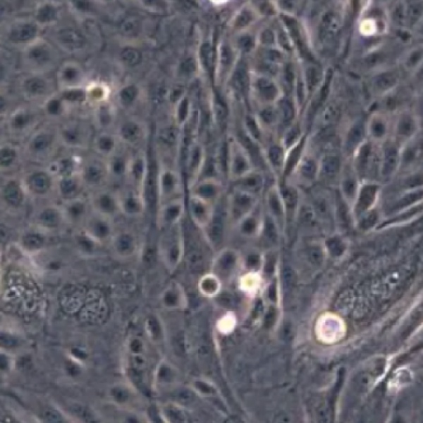 MB-49/MB49 小鼠膀胱癌细胞