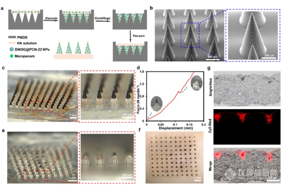 武汉大学药学院黎威课题组《Advanced Healthcare Materials》：多功能微针贴