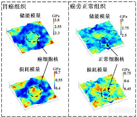 高稳定、高分辨、抗散射分光瞳激光差动共焦拉曼-布里渊图谱成像新方法