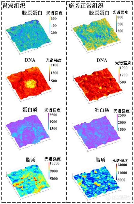 高稳定、高分辨、抗散射分光瞳激光差动共焦拉曼-布里渊图谱成像新方法