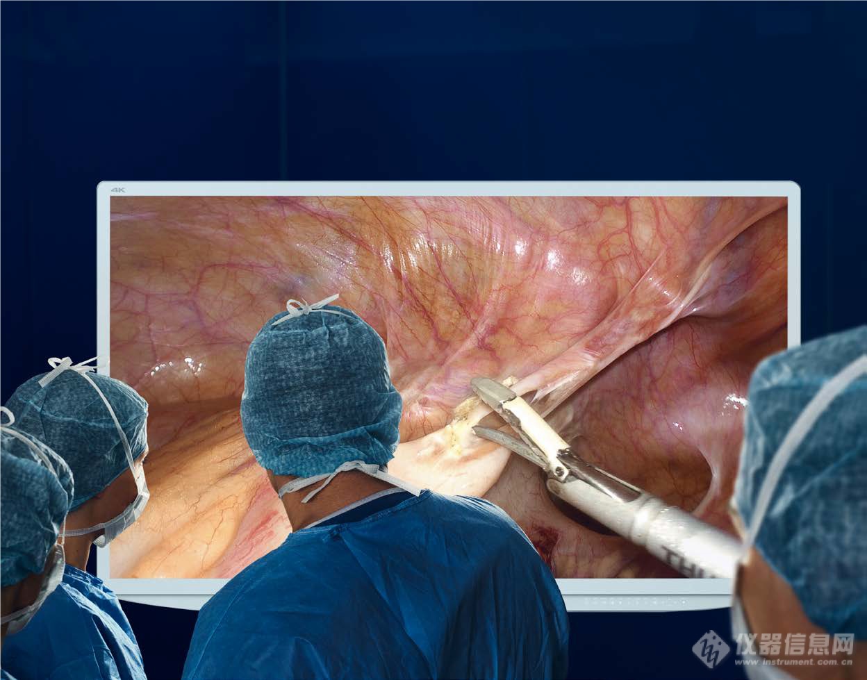 大屏幕手术腹腔镜
