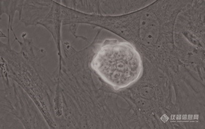 多能干细胞的Nanog基因表达（绿色荧光蛋白）