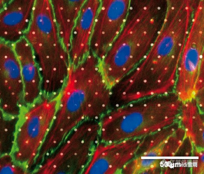 ibiPore可视化的Transwell:可实时观察流动、剪切力作用下细胞迁移、侵袭、细胞间相互作用